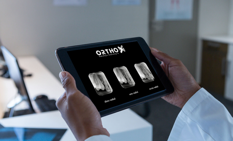 Ortho X - Método de Localização